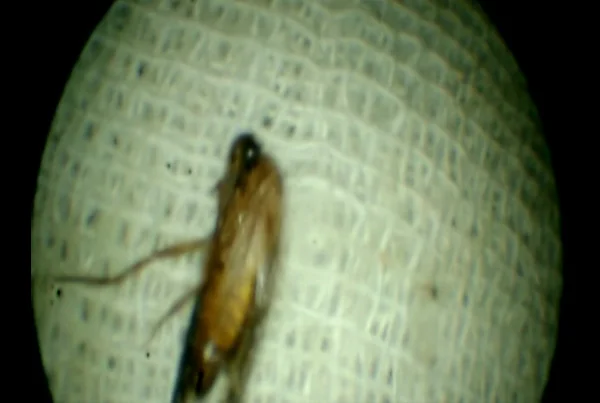 Foriegn Body in Ear
