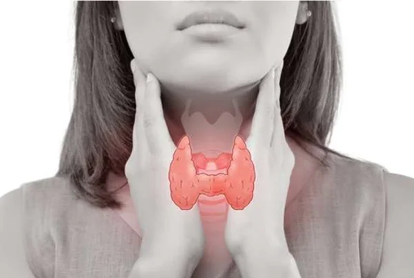 Thyroid Management