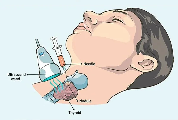 Head and Neck Biopsy