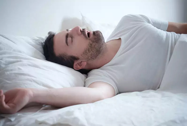 Snoring Management