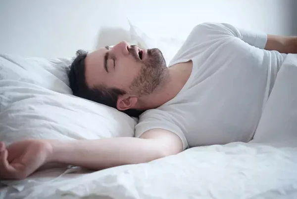 Snoring Management